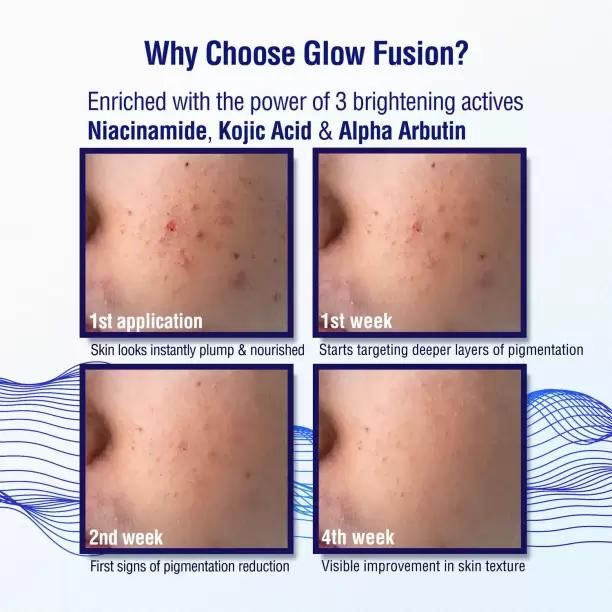 2% Kojic Acid Night Cream With Science 50g