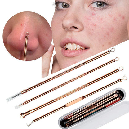 Cueen™ 4Pcs Blackhead Pimple Golden Remover Tools