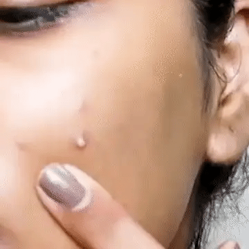 Cueen™ Acne Pimple Patch (72 Pieces)